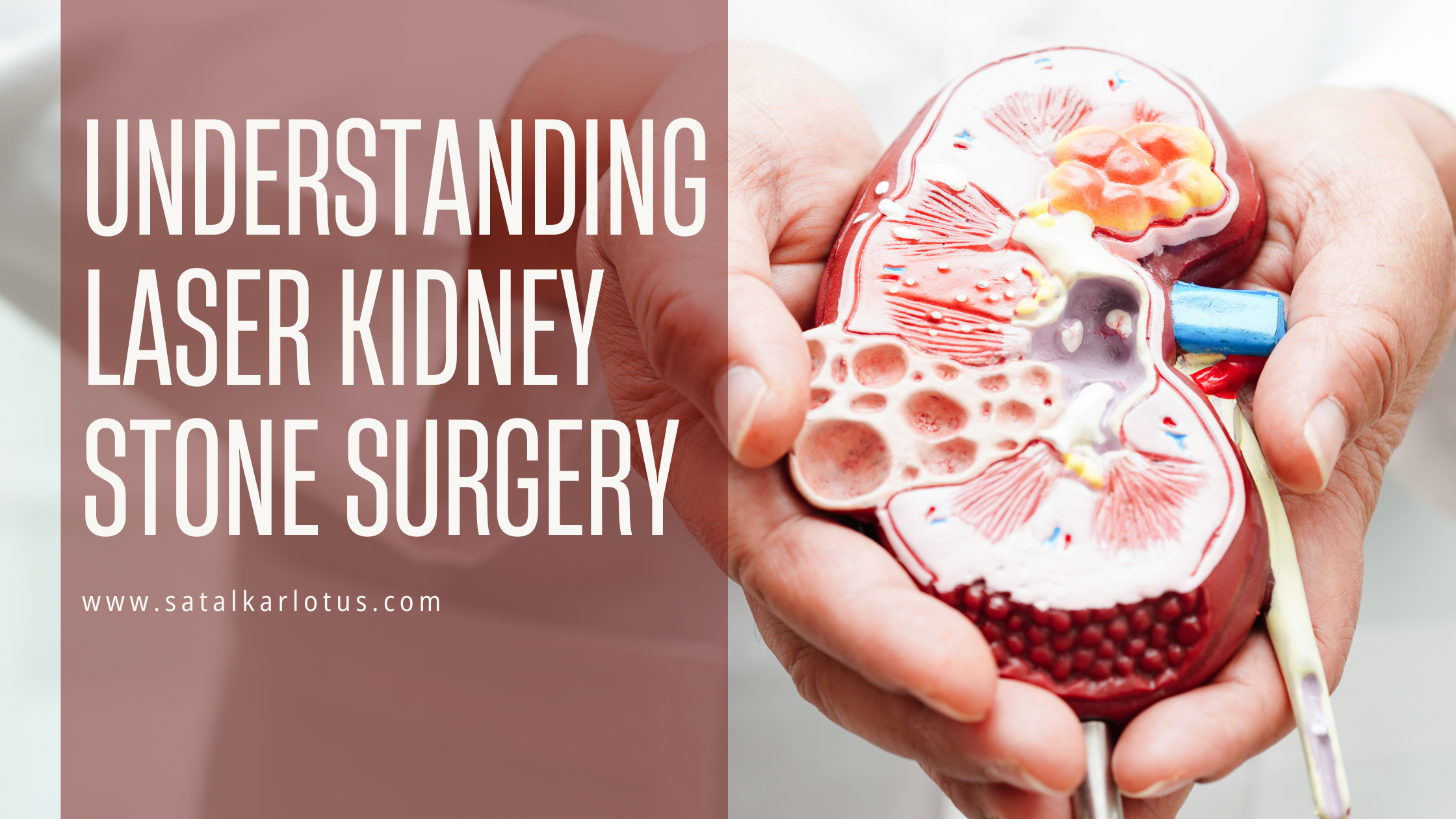 Understanding Laser Kidney Stone Surgery